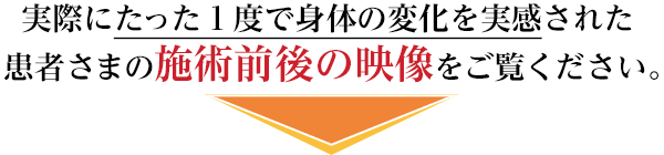 実際にたった１度で身体の変化を実感された患者さまの施術前後の映像をご覧ください。